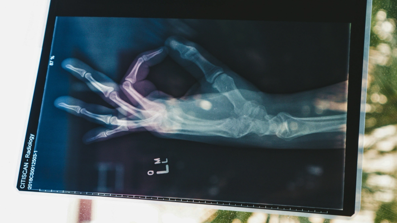 AI for Healthcare: Insights from India