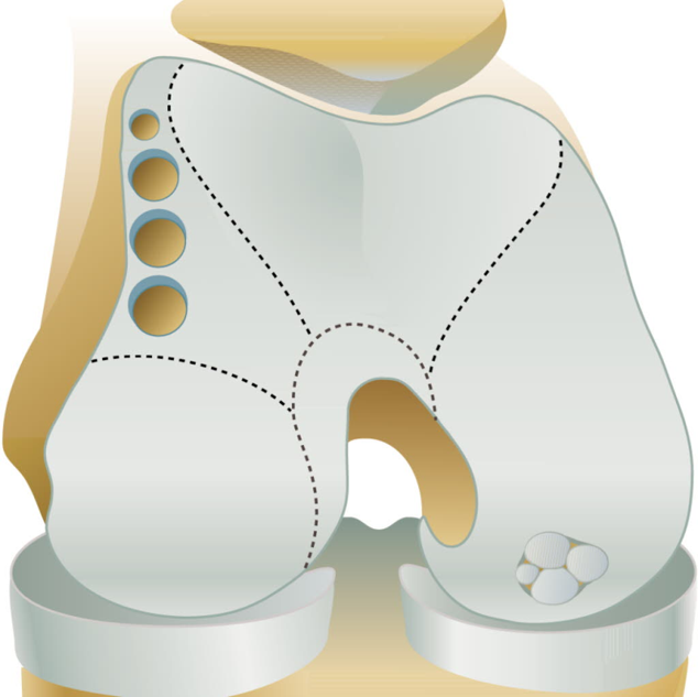 OATS Schematic