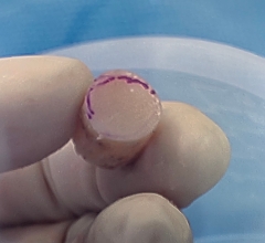 OATs plug ready for implantation