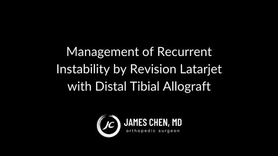 Management of Recurrent Instability by Revision Latarjet