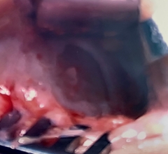 Open view of chondral lesion