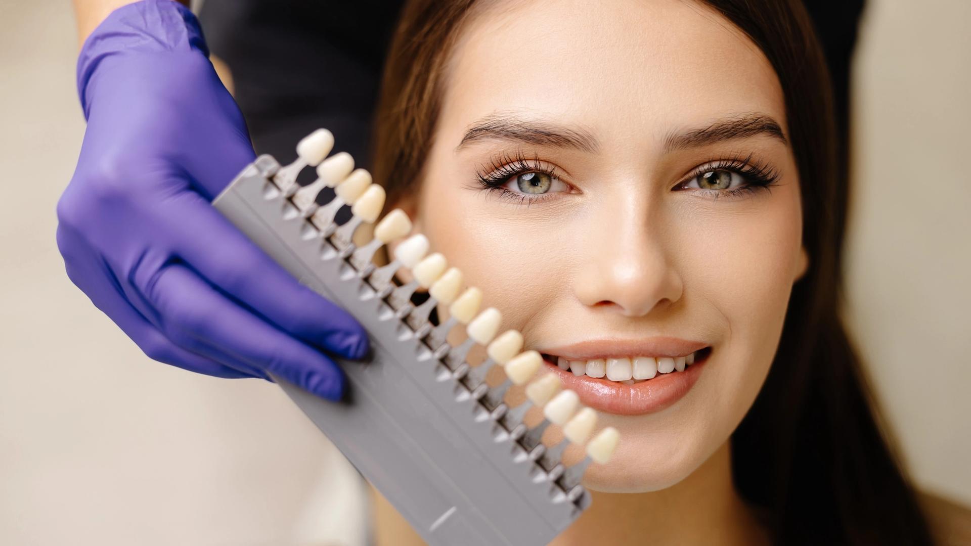 Dental Veneers Dubai | DRFK Natural Smile Makeovers