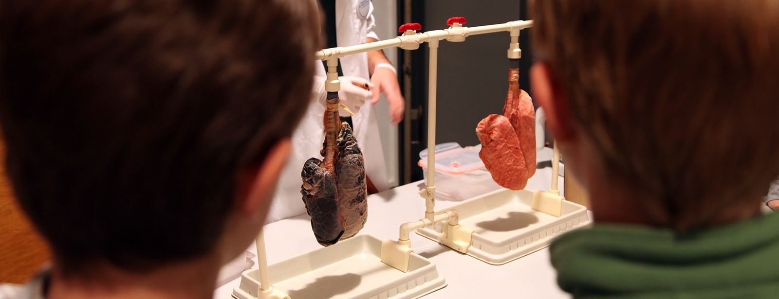Two children view an artificially stained dark pig lung beside an unstained pink pig lung at a smoking-prevention display.