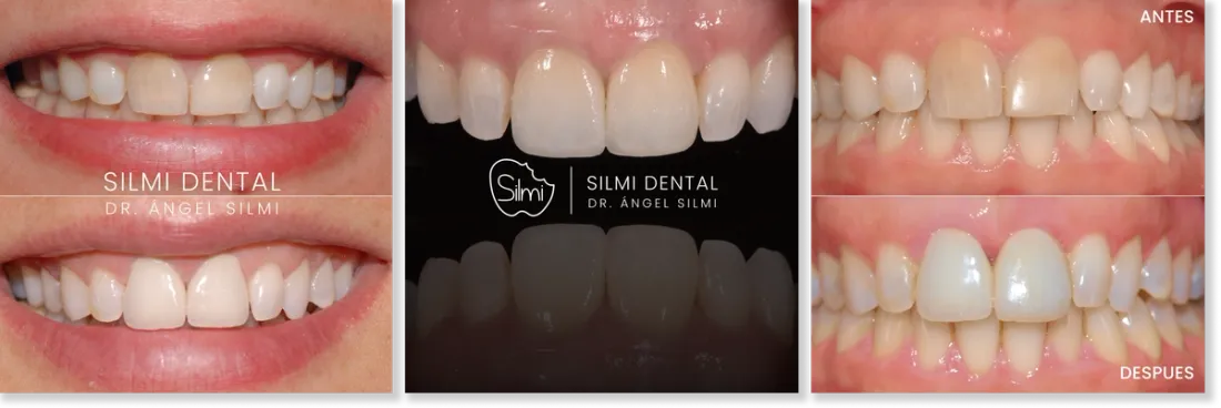 Imagen de tecnicas de Silmi Dental