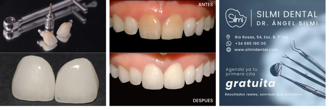 Imagen de tecnicas de Silmi Dental