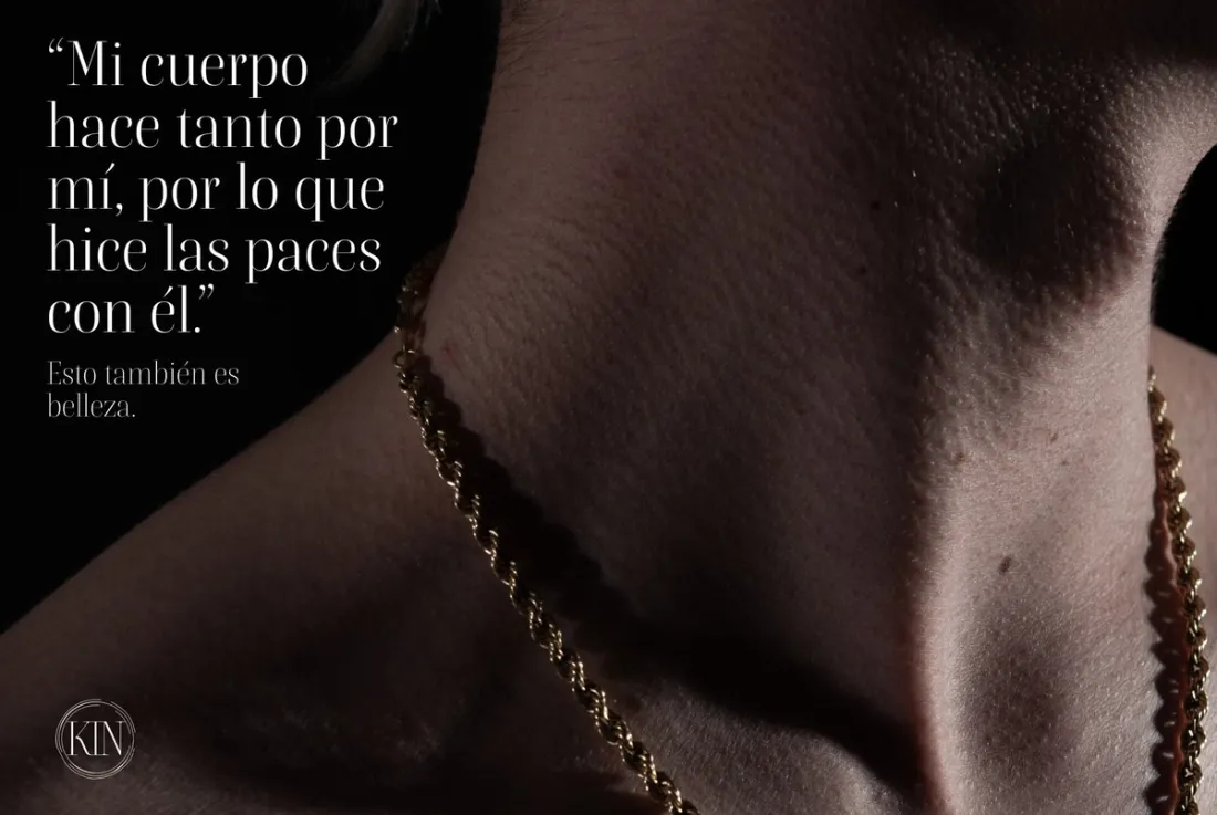 Imagen de portada de KIN