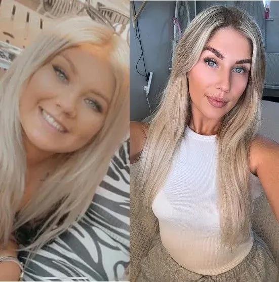 Close-up of Danielle before and after using Mounjaro