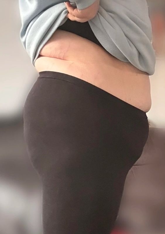 before-image