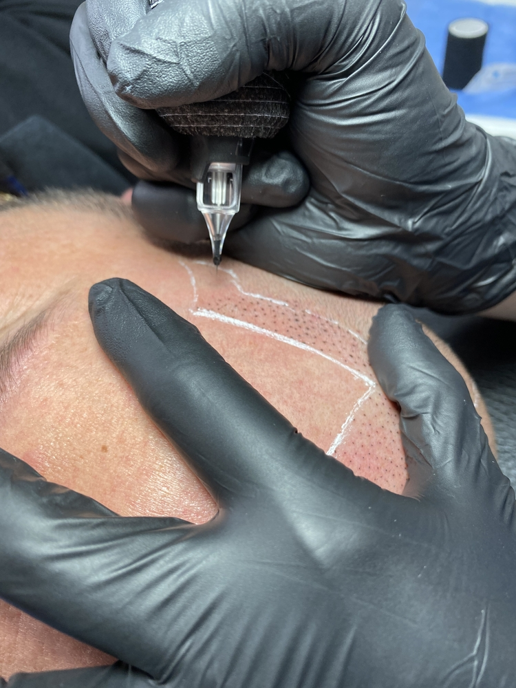 Man scalp tattoo