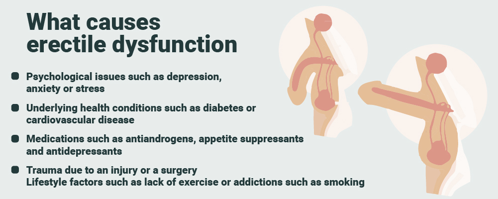 Erectile dysfunction causes