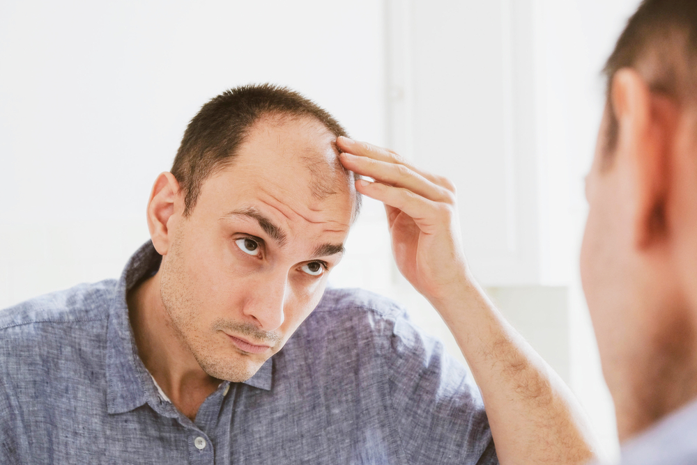 man in the mirror hair loss