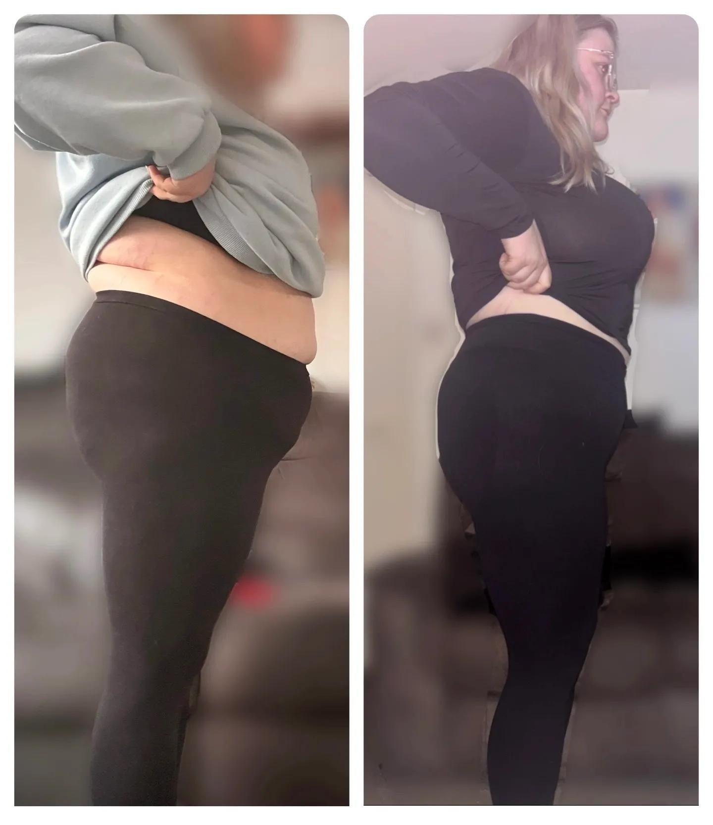 Shania showing her before and after, losing 21kg with Mounjaro and Voy.