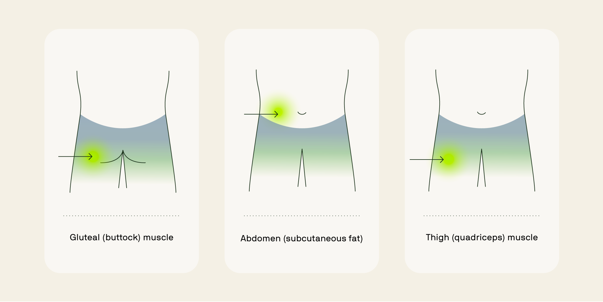 Body areas used for testosterone injections, highlighting the buttock, abdomen, and thigh.