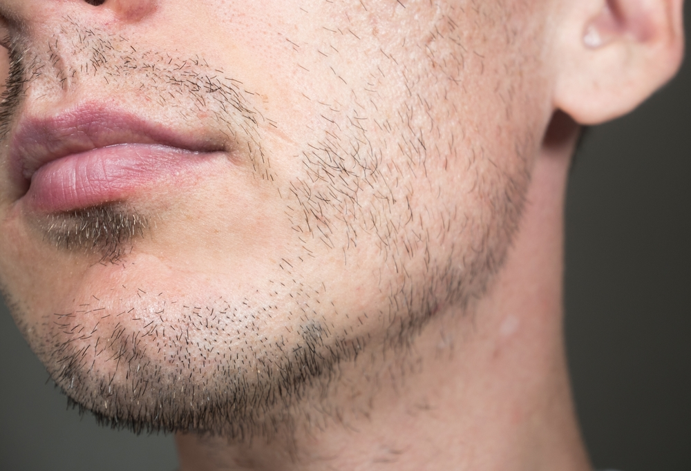 beard close up