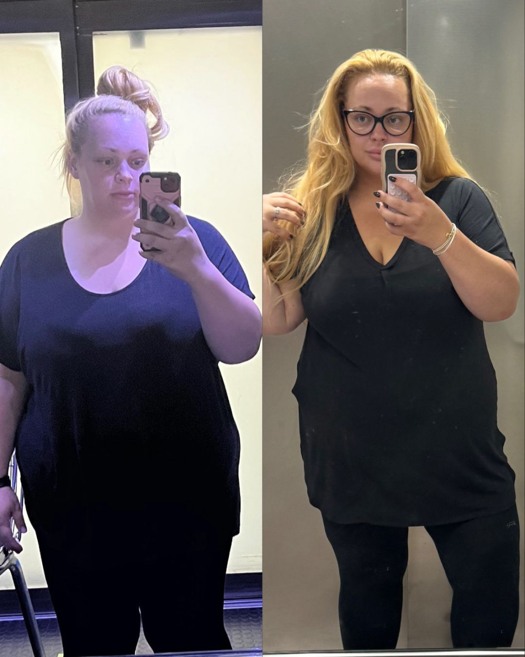 Camilla sharing her 51kg weight loss results before and after using Mounjaro and Voy.