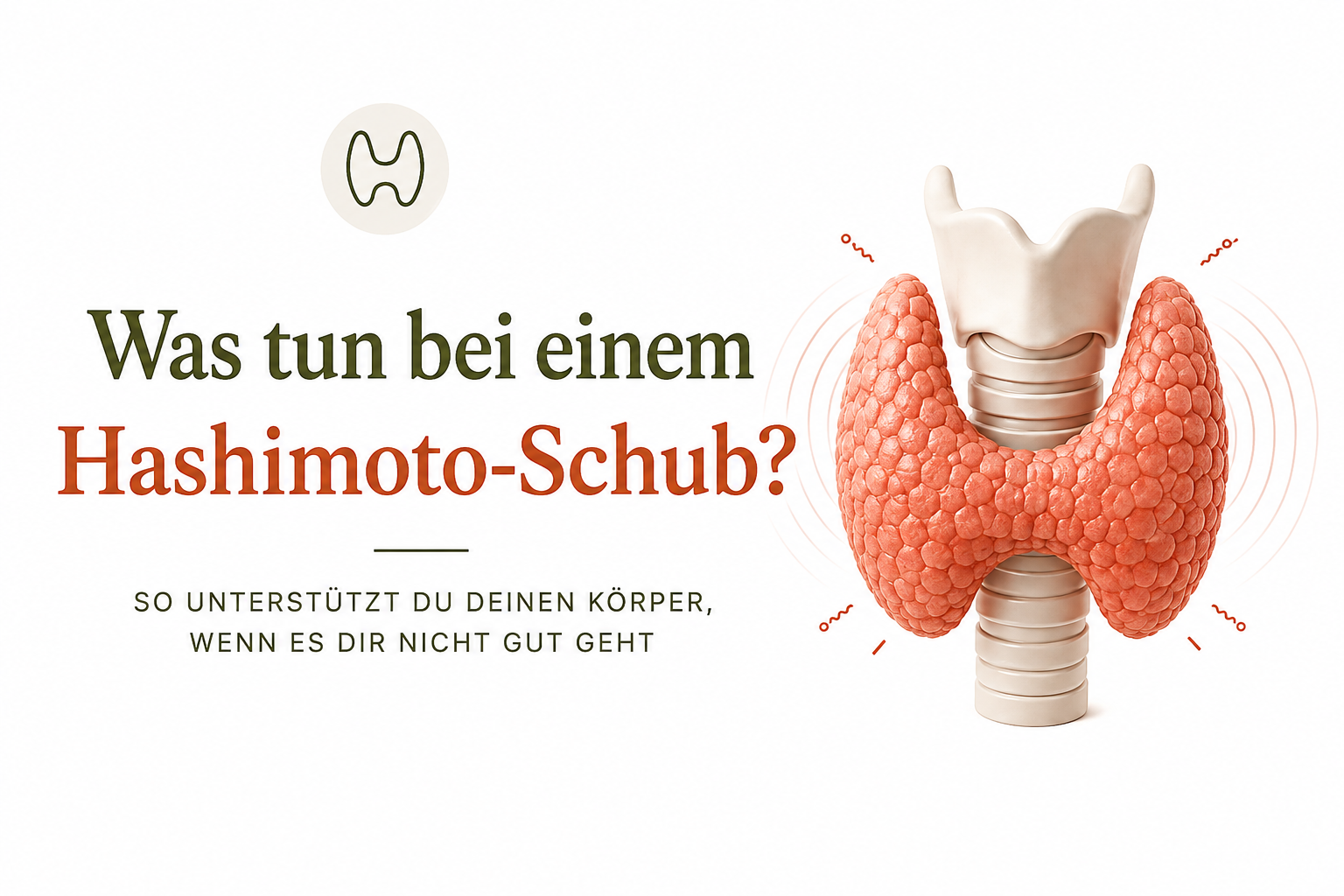 Was tun bei einem Hashimoto-Schub? Blog-Titelbild mit einer Tasse Tee und Tipps zum Umgang mit einem Hashimoto-Schub.