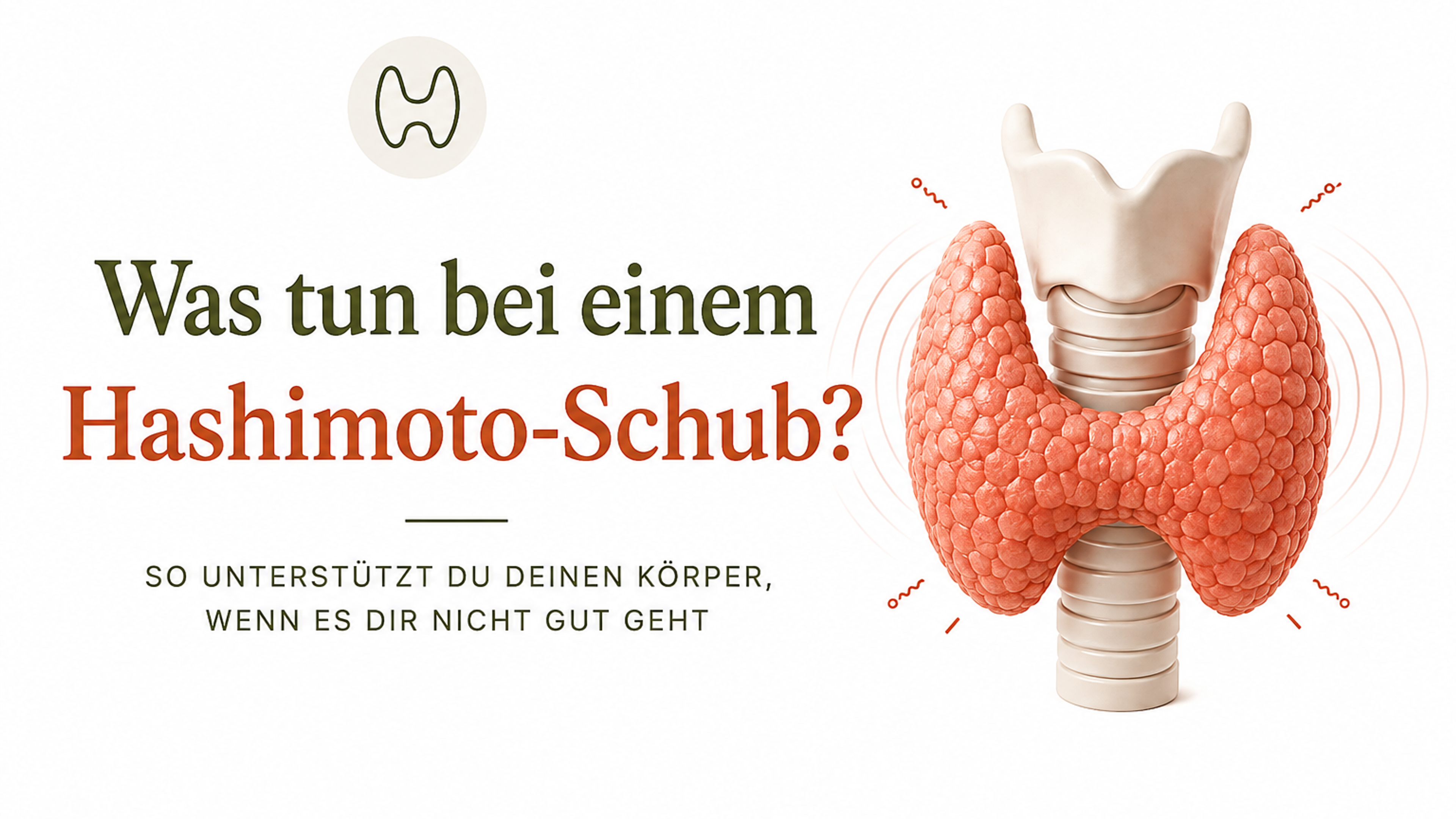 Was tun bei einem Hashimoto-Schub? Blog-Titelbild mit einer Tasse Tee und Tipps zum Umgang mit einem Hashimoto-Schub.