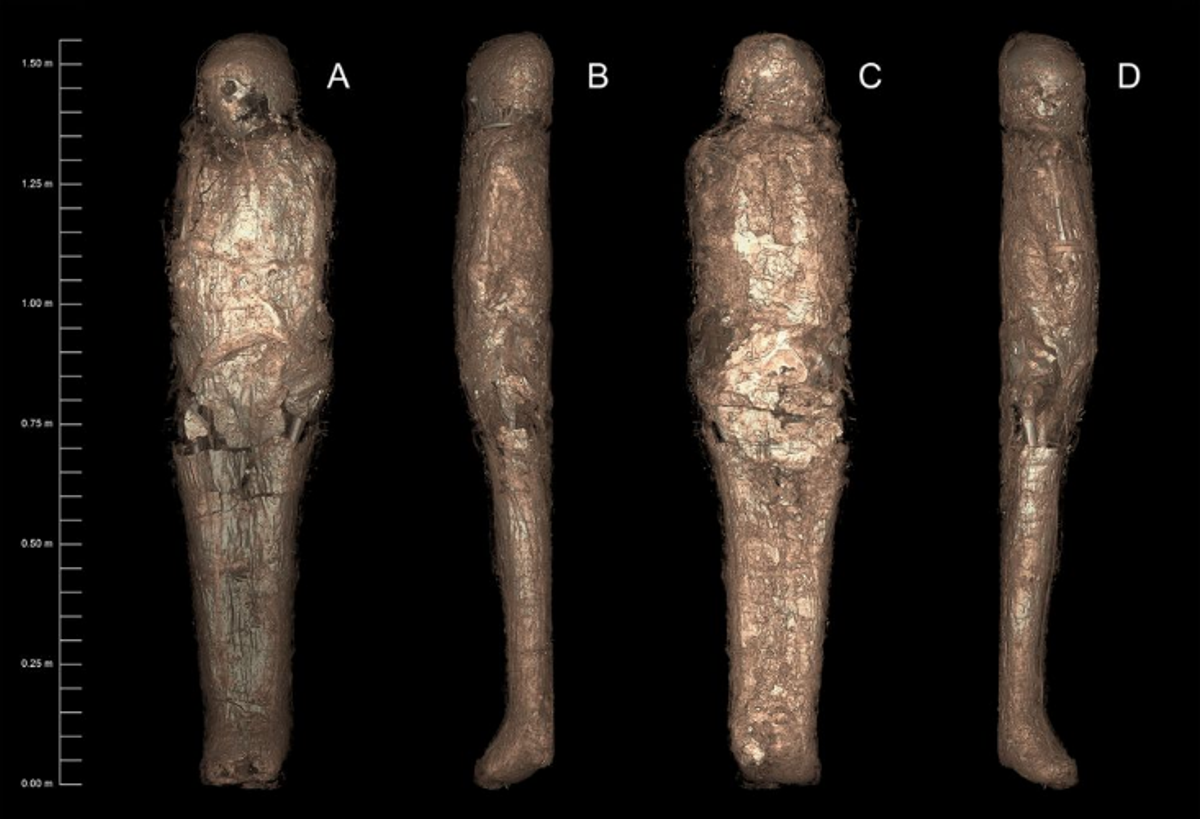 3D-rendered CT images of mummified individual showing the carapace and broken sections Photo: Sowada et al, PLOS ONE, courtesy Chau Chak Wing Museum and Macquarie Medical Imaging