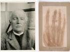 Blood, skeletons and syphilis: the story of Edvard Munch’s obsession with health