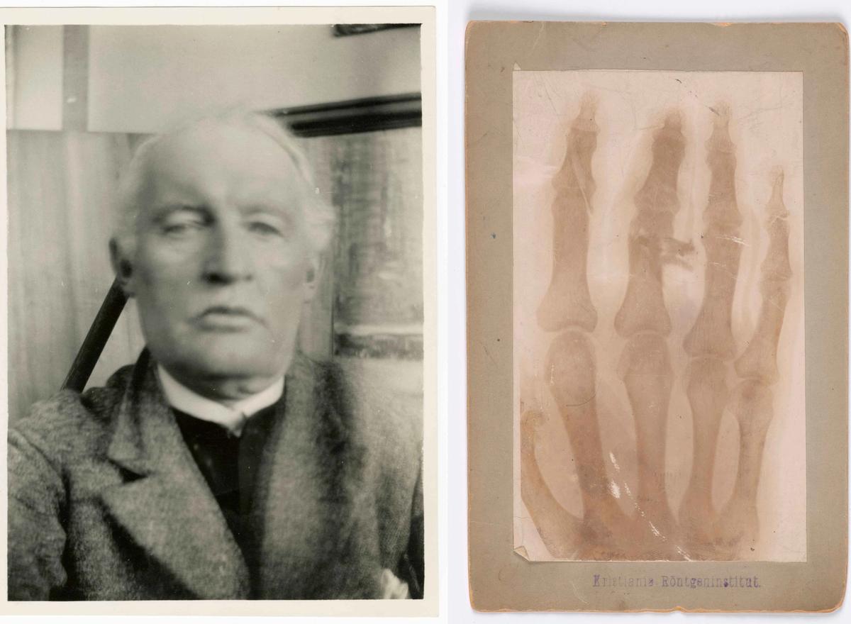 Left: Edvard Munch, Self-Portrait in front of The Death of Marat, Ekely (1930). Right: X-ray image of Edvard Munch's left hand (1902)
Self-portrait: Photo: Munch Museum / Edvard Munch. X-ray: Photo: Halvor Bjørngård, courtesy of Munchmuseet