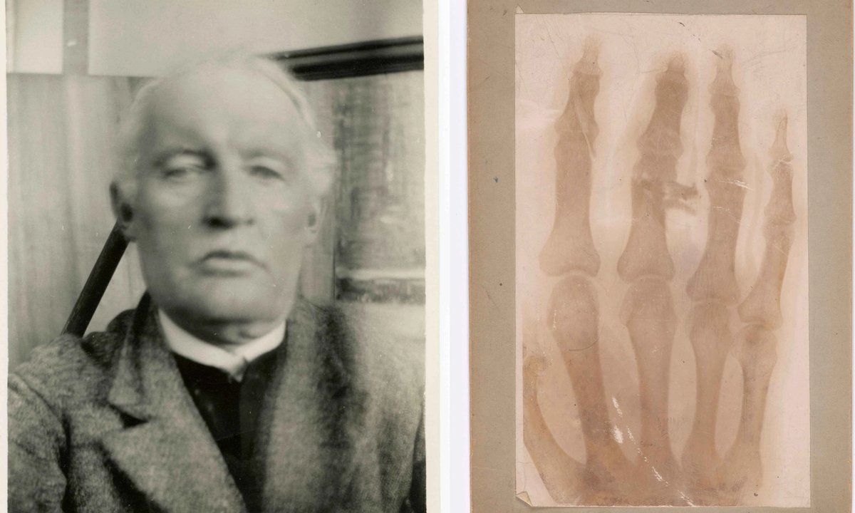 Blood, skeletons and syphilis: the story of Edvard Munch's obsession with health