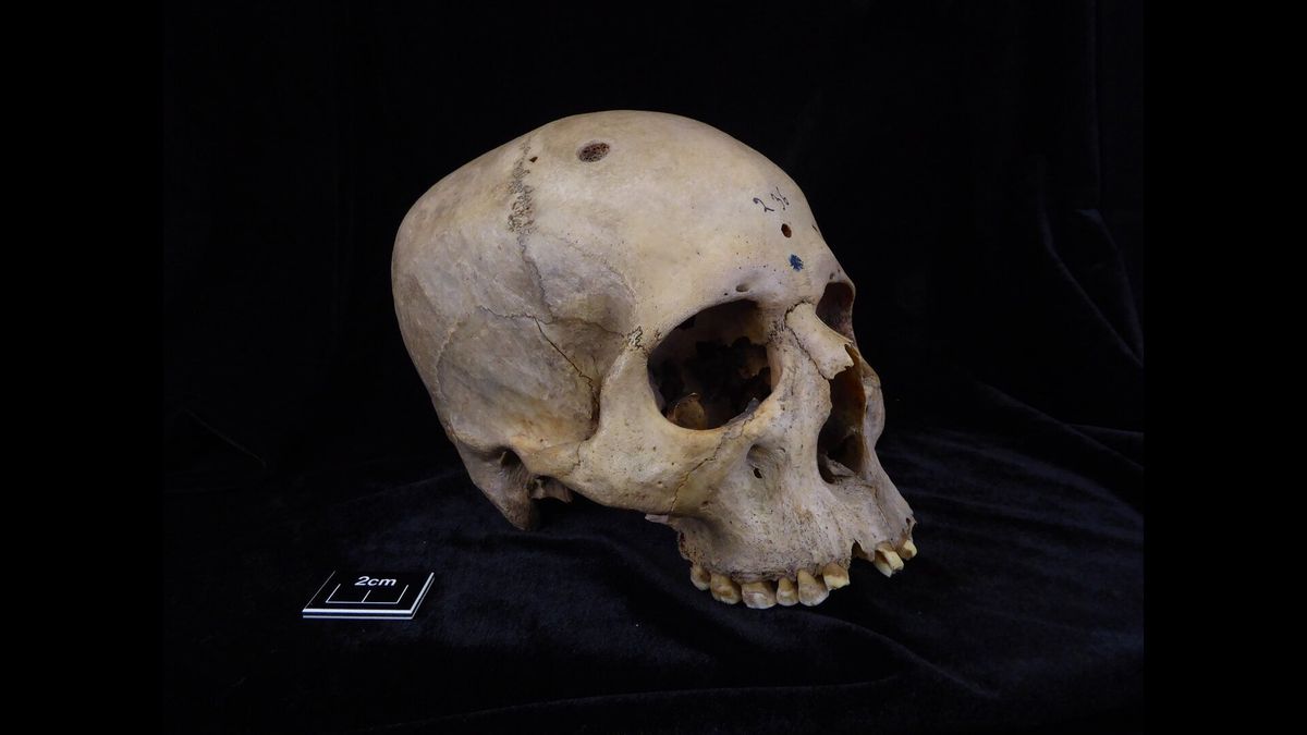 Skull and mandible 236, which dates from between 2687 and 2345 BCE, and belonged to a male individual aged 30 to 35
Tondini, Isidro, Camarós, 2024