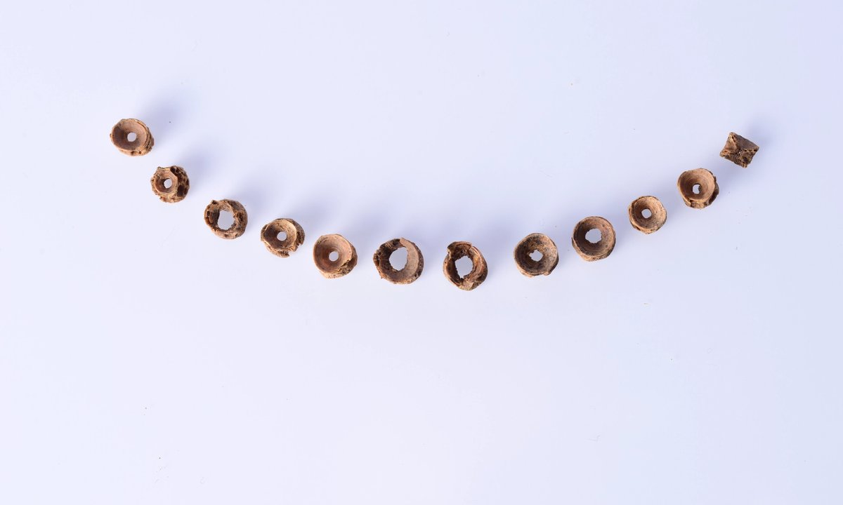 Britain’s oldest prayer beads—buried greater than 1,000 years in the past—to be displayed in new museum on distant island Britain’s oldest prayer beads—buried greater than 1,000 years in the past—to be displayed in new museum on distant island