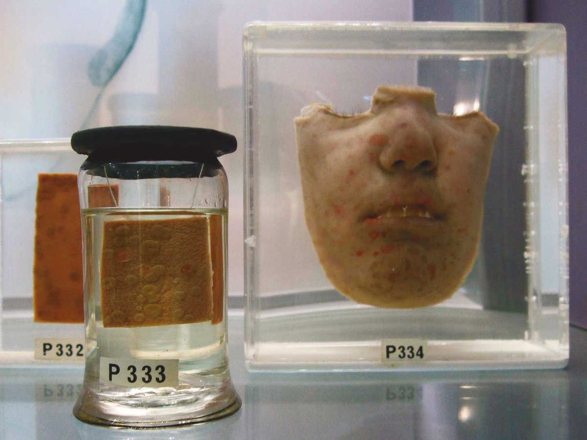 Human remains at the newly reopened Hunterian Museum in London
Courtesy Hunterian Museum. Photo © Stefan Schäfer