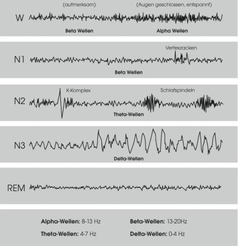 EMG-Wellen während Schlaf