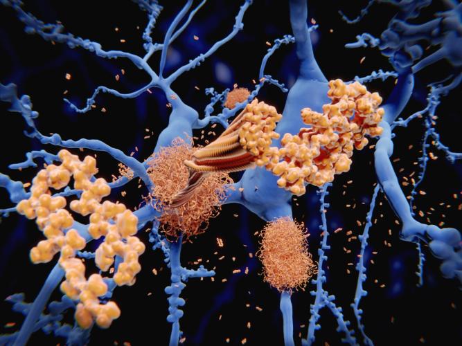 beta-Amyloid-Protein Neuronen Schlaf