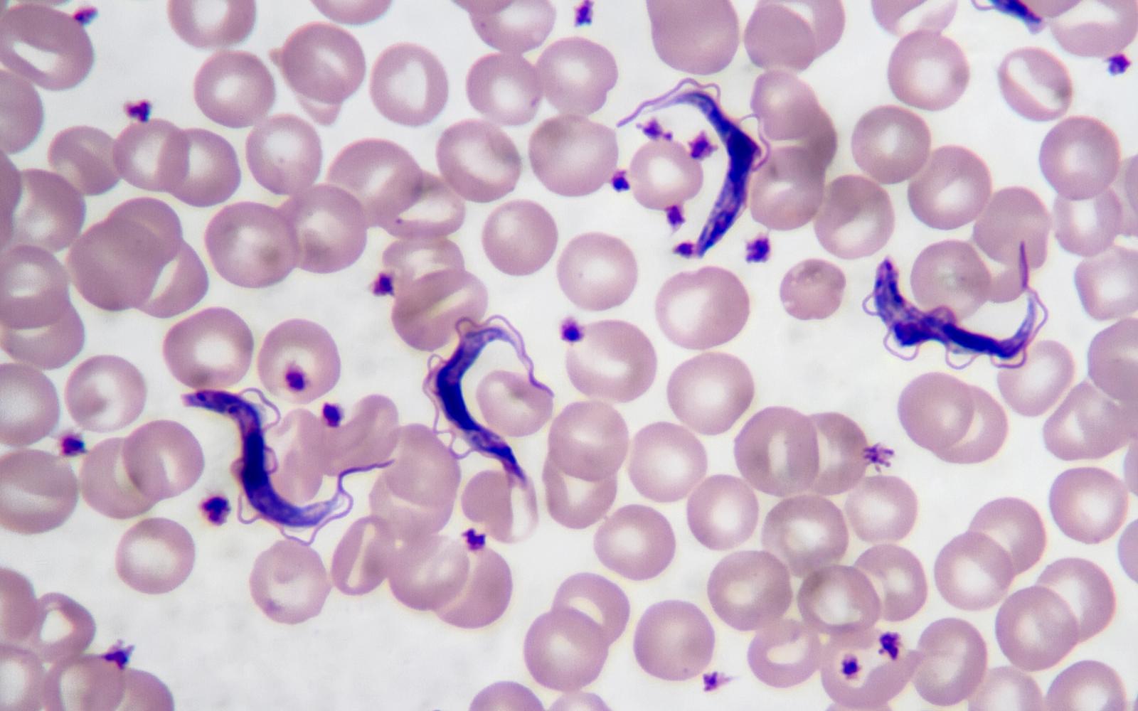 Die Schlafkrankheit: Gefahr durch die Tsetse-Fliege