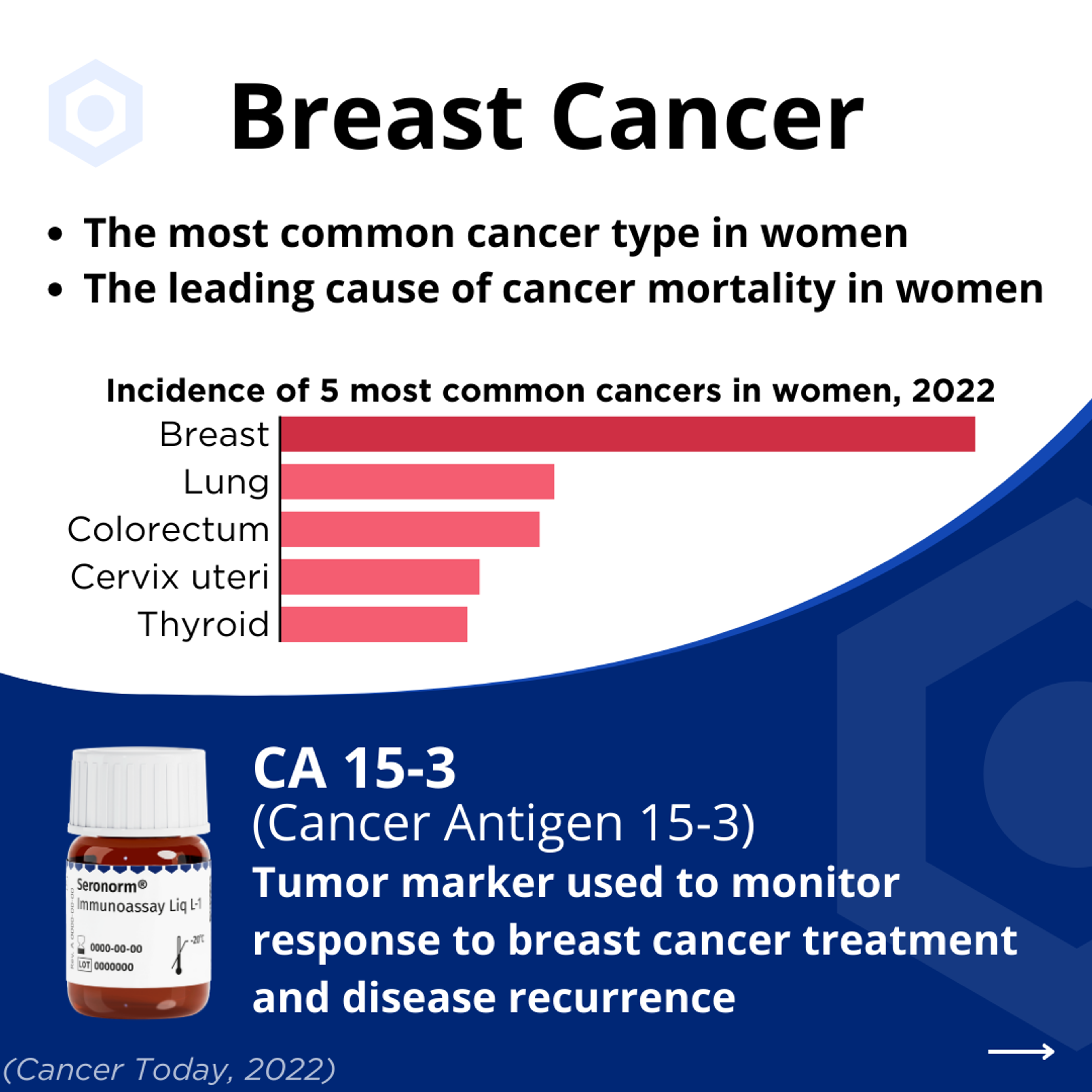 Infographic about breast cancer, detailing its prevalence as the most common cancer and leading cause of mortality in women, featuring a bar chart of top cancers and information on the CA 15-3 tumor marker.