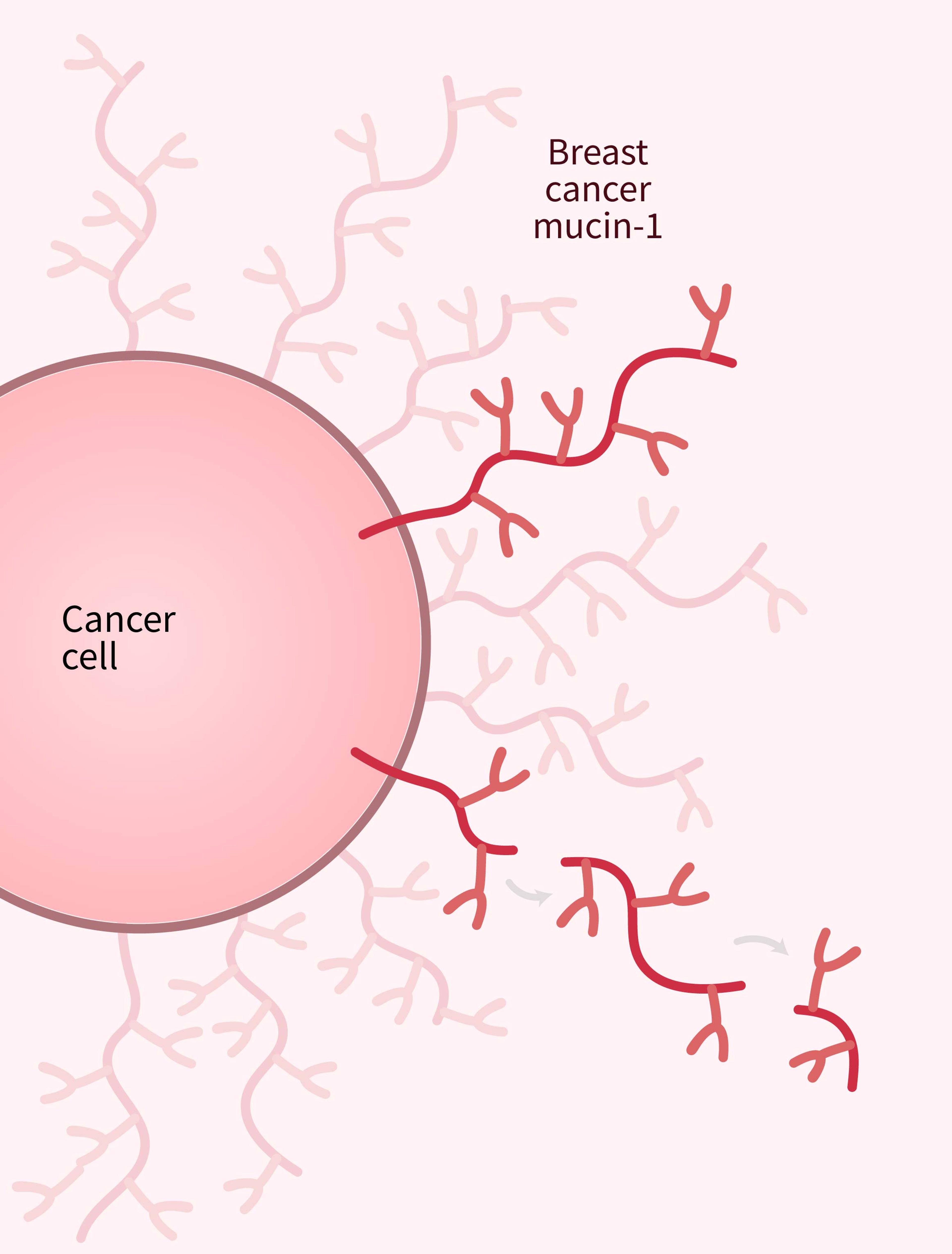 A cancer cell releasing branched breast cancer mucin-1 proteins, some of which are shown detaching.