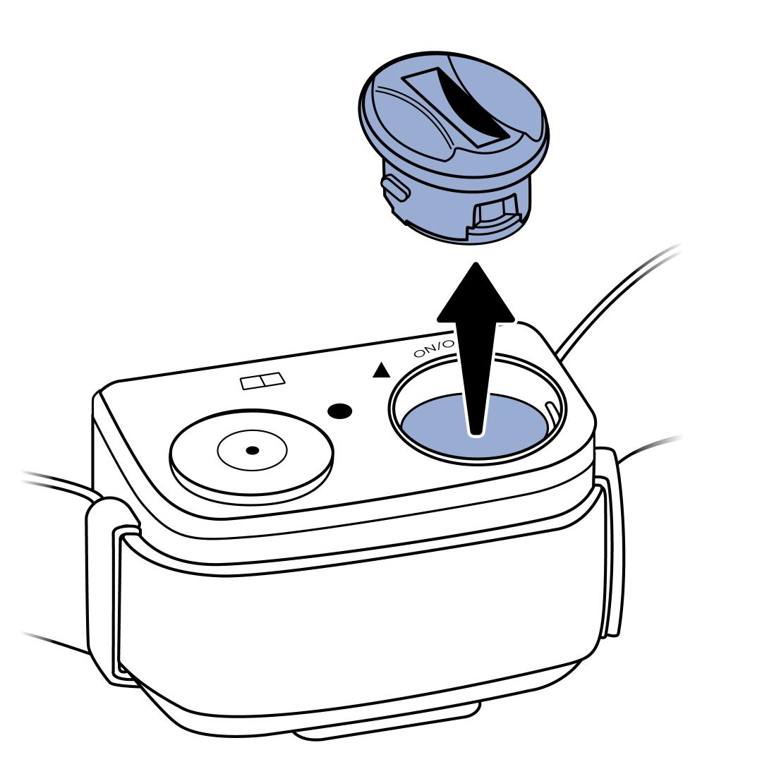Battery cap removal