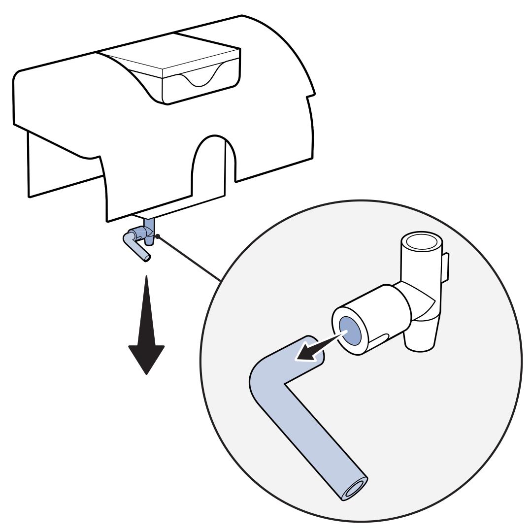 Remove T Tube And Separate