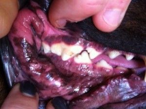 Mild tartar gingivitis can build-up without proper dental health care.