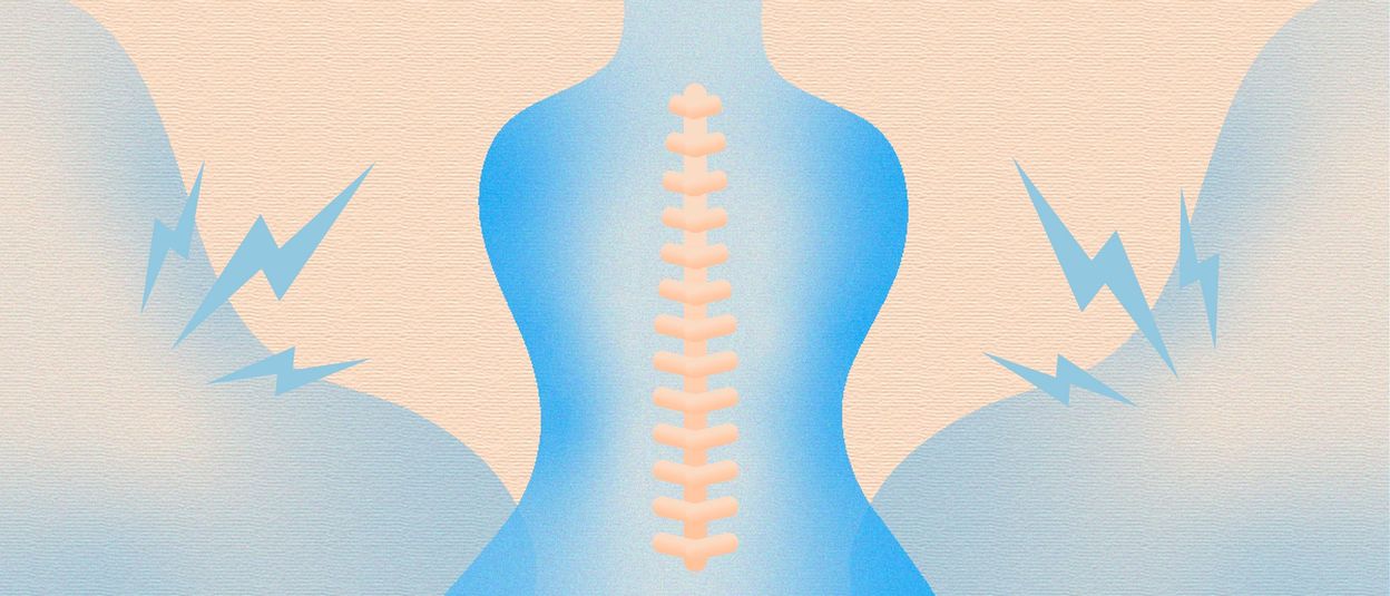 Comic stylized image of a back with the spine outlined, sharp blue lightning bolts to represent pain radiating on both sides of the body, all on a cream coloured background