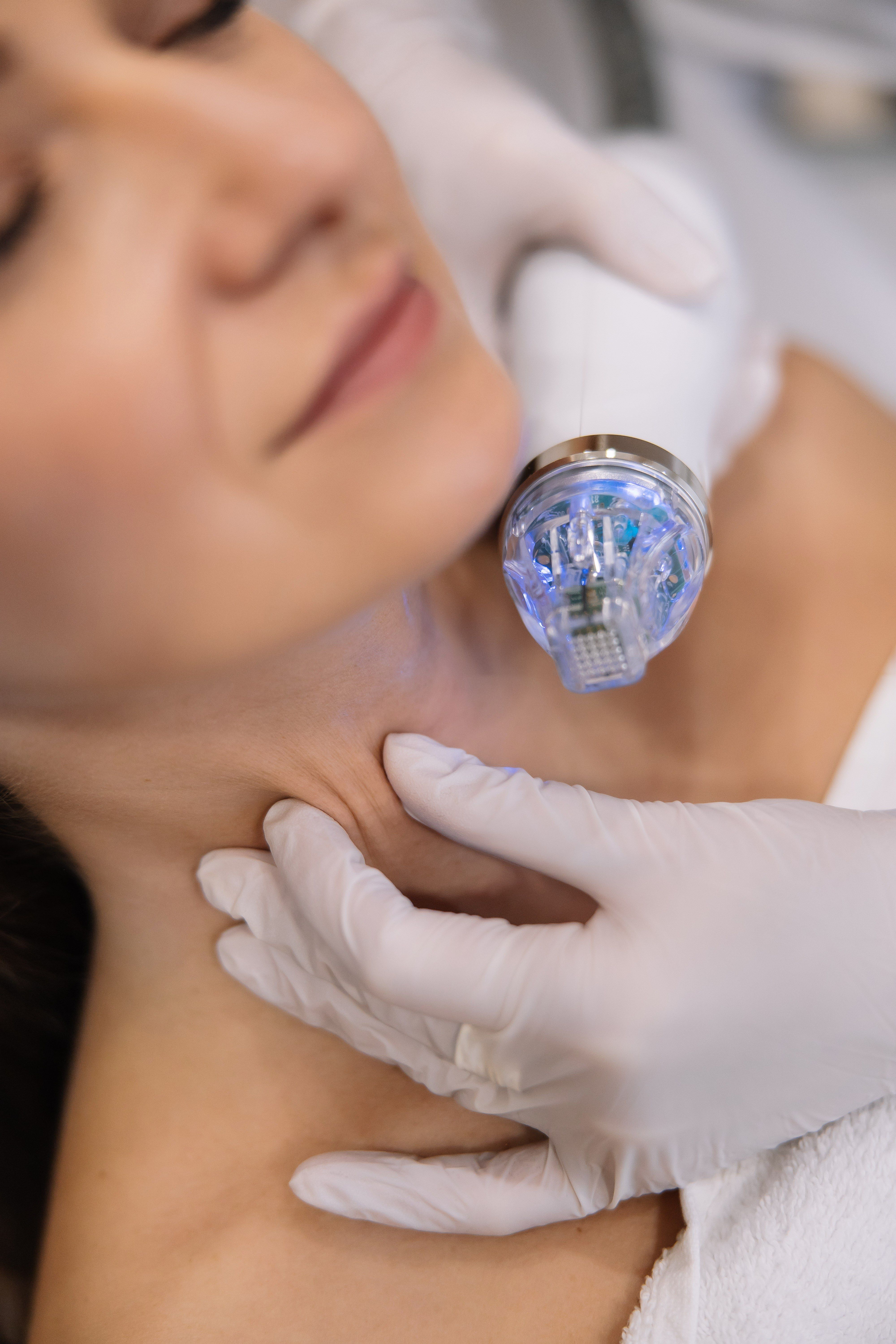 Мікроголковий ліфтинг Secret RF