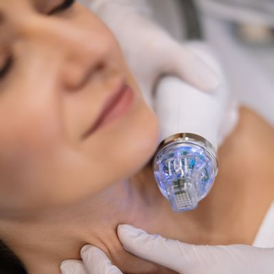 Мікроголковий ліфтинг Secret RF