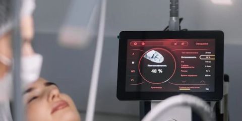 Мікроголковий Secret RF: Ефективне омолодження шкіри