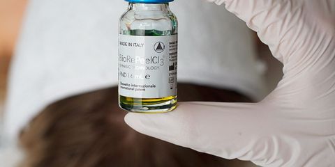 Пілінги PRX-T33 та BioRePeel: омолодження та відновлення шкіри без болю та реабілітації
