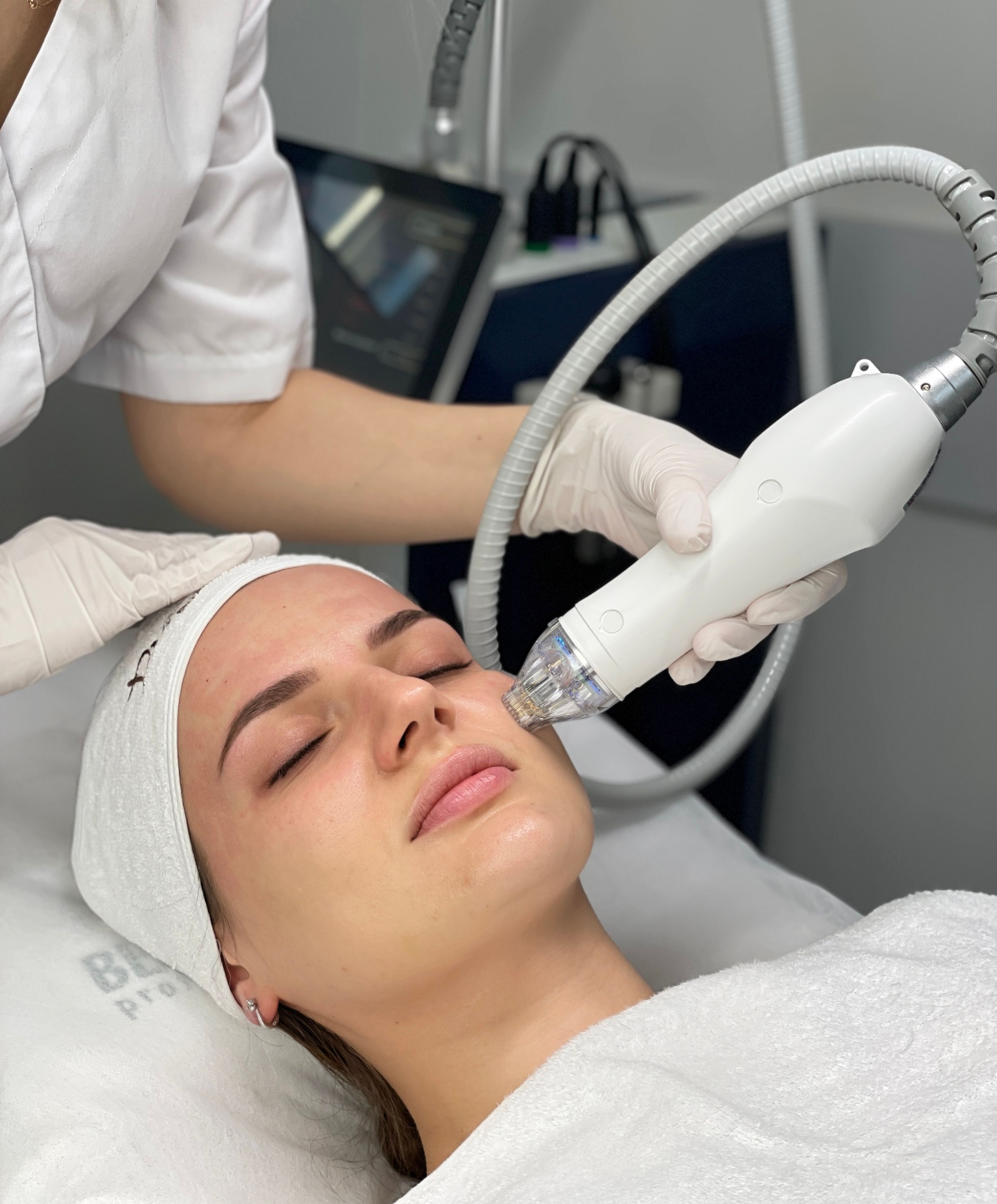 Secret Rf (обличчя) + Feijia (1 шприц)