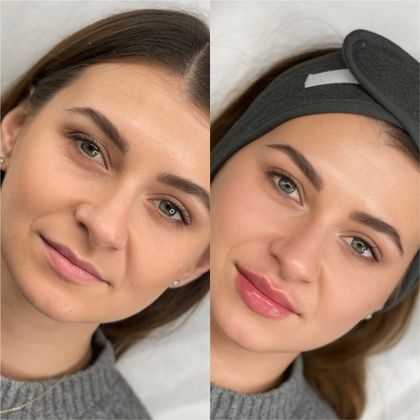 Результати процедури