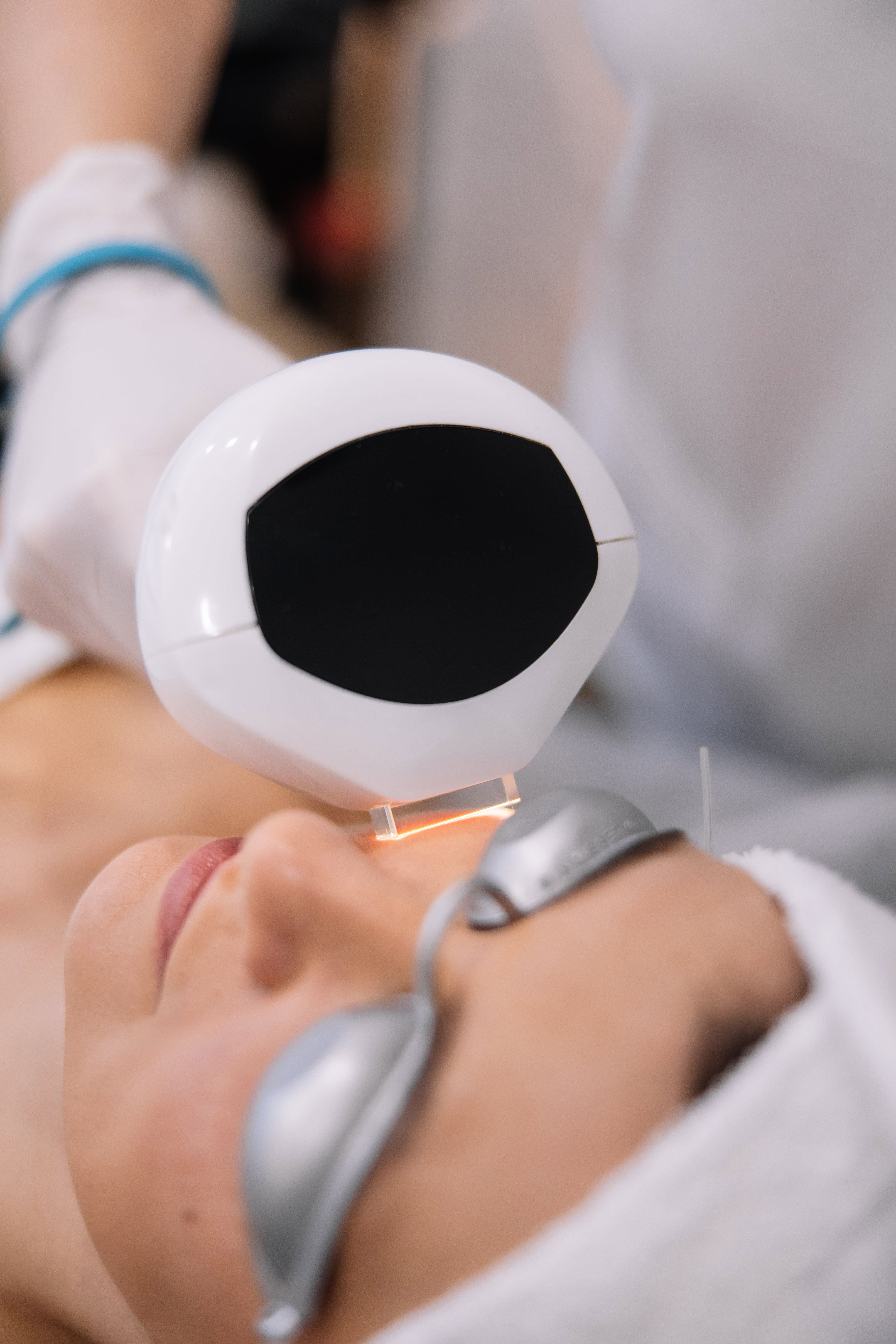 IPL-терапія (обличчя)