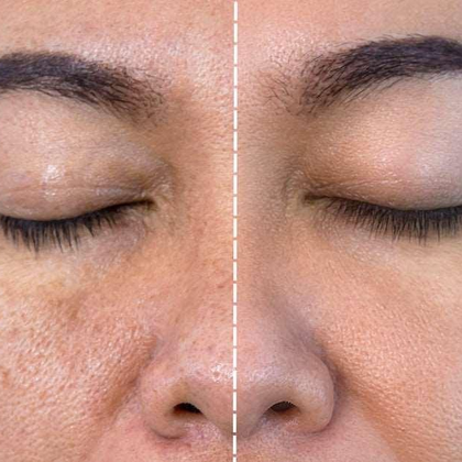 Результати процедури