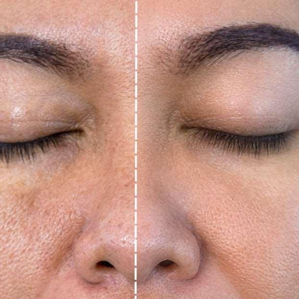 Результати процедури