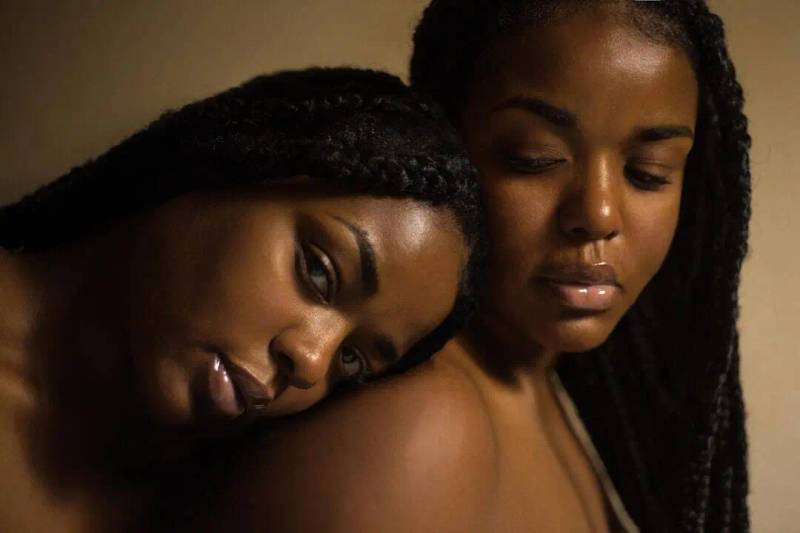 Recognizing Dermatoses in Skin of Color