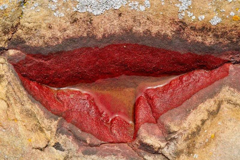 Oral Squamous Cell Carcinomas and Salivary Gland Neoplasms