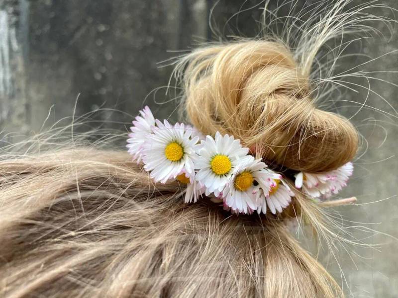 Hair Loss in Children