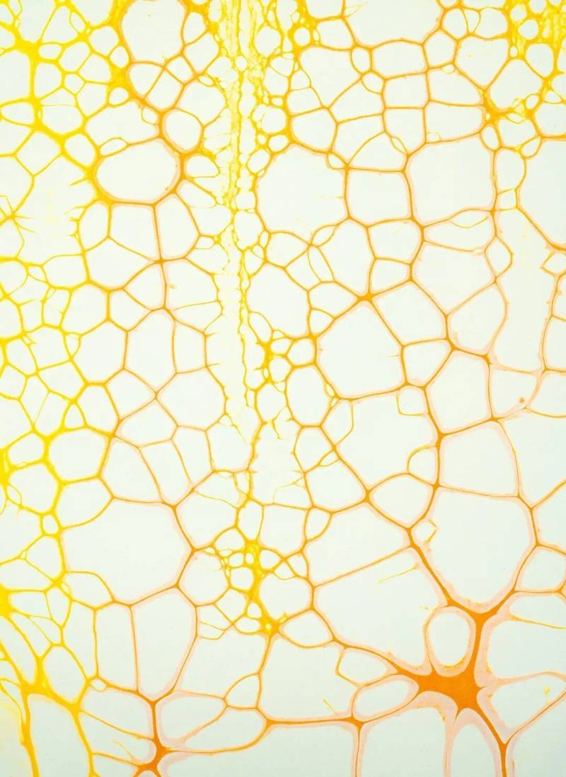 Fundamentals of Immunology in Atopic Dermatitis